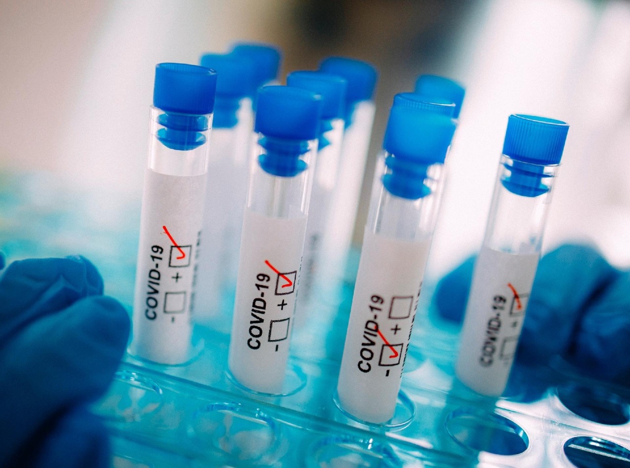 O exame RT-PCR para diagnóstico da Covid-19 está disponÃvel no Centro MS
