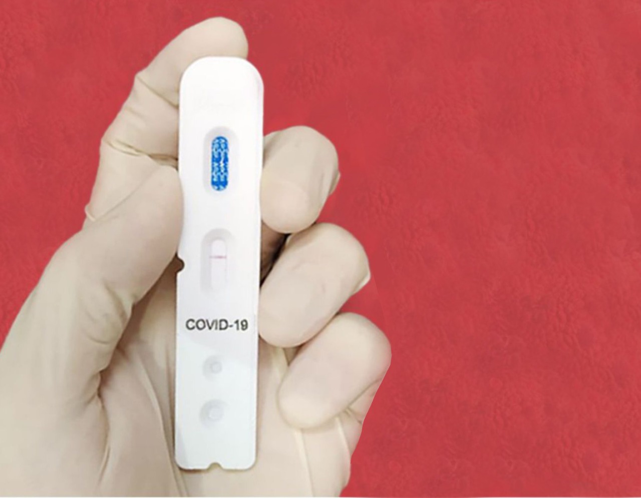 O teste rápido para diagnóstico da Covid-19 está disponÃvel no Centro Médico Sapiranga