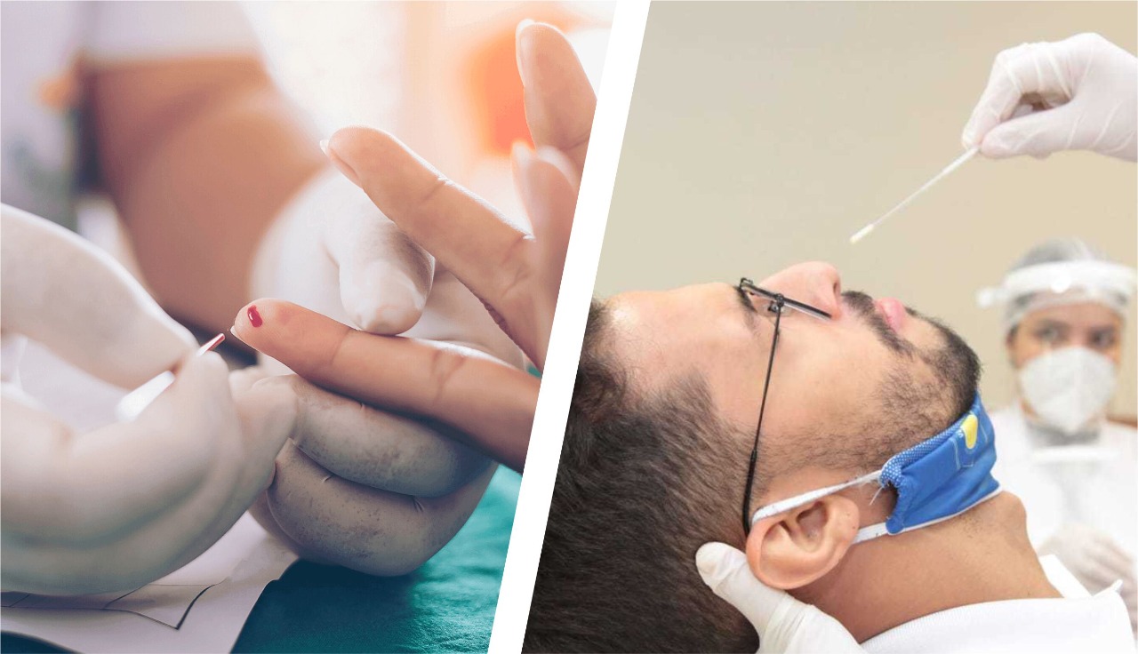 Conheça os testes disponíveis para Covid-19 no Centro Médico Sapiranga